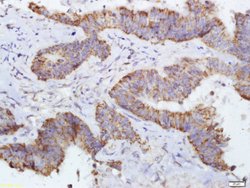 DERLIN-1 Rabbit anti-Human, Polyclonal, Bioss 100 &mu;L; Unconjugated:Antibodies,