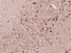 FKBP51 Rabbit anti-Human, Polyclonal, Bioss 100 &mu;L; Unconjugated:Antibodies,