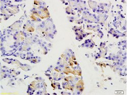 SGCB/SGC Rabbit anti-Human, Polyclonal, Bioss 100 &mu;L; Unconjugated:Antibodies,
