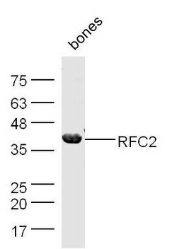 RFC2 Rabbit anti-Human, Polyclonal, Bioss 100 &mu;L; Unconjugated:Antibodies,