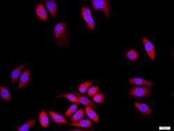 SAP102/DLG3 Rabbit anti-Human, Polyclonal, Bioss 100 &mu;L; Unconjugated:Antibodies,