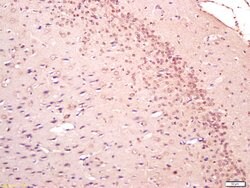 SAP102/DLG3 Rabbit anti-Human, Polyclonal, Bioss 100 &mu;L; Unconjugated:Antibodies,