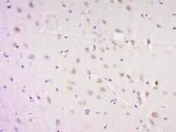 SNAP91/AP180 Rabbit anti-Human, Polyclonal, Bioss 100 &mu;L; Unconjugated:Antibodies,