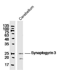 Synaptogyrin 3 Rabbit anti-Human, Polyclonal, Bioss 100 &mu;L; Unconjugated:Antibodies,