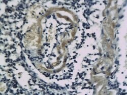 SSTR2/Somatostatin Receptor 2 Rabbit anti-Human, Polyclonal, Bioss 100