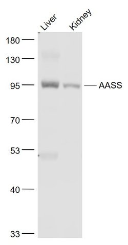 AASS/LKRSDH Rabbit anti-Human, Polyclonal, Bioss 100 &mu;L; Unconjugated:Antibodies,