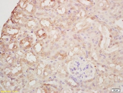 Arginase 2 Rabbit anti-Human, Polyclonal, Bioss 100 &mu;L; Unconjugated:Antibodies,