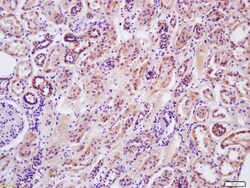 Arginase 2 Rabbit anti-Human, Polyclonal, Bioss 100 &mu;L; Unconjugated:Antibodies,