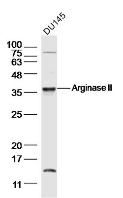 Arginase 2 Rabbit anti-Human, Polyclonal, Bioss 100 &mu;L; Unconjugated:Antibodies,