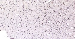 AKR1C3/DD3 Rabbit anti-Human, Polyclonal, Bioss 100 &mu;L; Unconjugated:Antibodies,