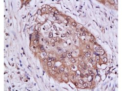 STAT3 Rabbit anti-Human, Polyclonal, Bioss 100 &mu;L; Unconjugated:Antibodies,