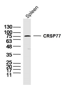 CRSP77 Rabbit anti-Human, Polyclonal, Bioss 100 &mu;L | Buy Online | Bioss | Fisher Scientific