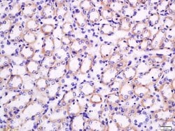 Nocturnin Rabbit anti-Human, Polyclonal, Bioss 100 &mu;L; Unconjugated:Antibodies,