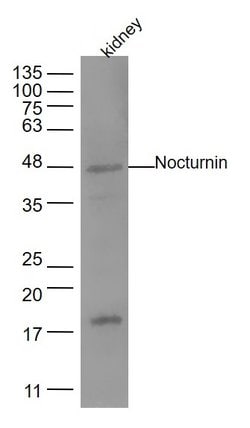 Nocturnin Rabbit anti-Human, Polyclonal, Bioss 100 &mu;L; Unconjugated:Antibodies,