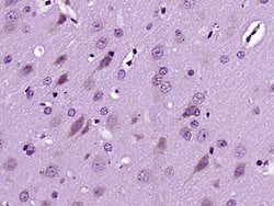 Dscam Rabbit anti-Human, Polyclonal, Bioss 100 &mu;L; Unconjugated:Antibodies,