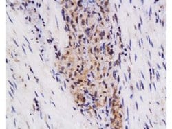 TSLC1 Rabbit anti-Human, Polyclonal, Bioss 100 &mu;L; Unconjugated:Antibodies,