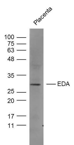 EDA Rabbit anti-Human, Polyclonal, Bioss 100 &mu;L; Unconjugated:Antibodies,