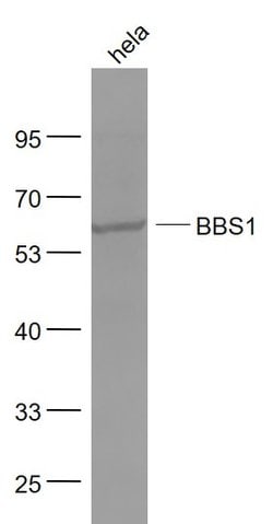 BBS1 Rabbit anti-Human, Polyclonal, Bioss 100 &mu;L; Unconjugated:Antibodies,