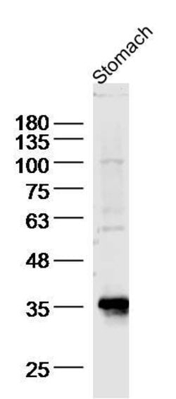 BBS8/TTC8 Rabbit anti-Human, Polyclonal, Bioss 100 &mu;L; Unconjugated:Antibodies,