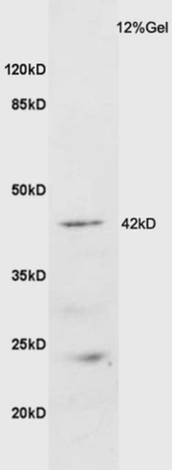 GALR2 Rabbit anti-Human, Polyclonal, Bioss 100 &mu;L; Unconjugated:Antibodies,