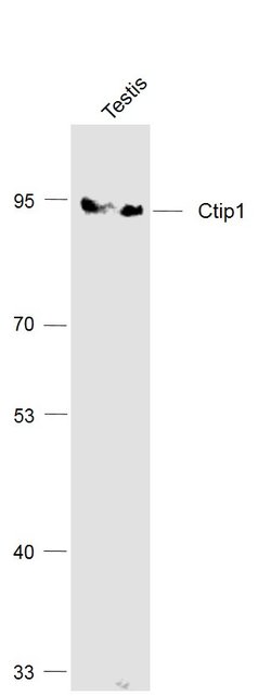 Ctip1/BCL-11A Rabbit anti-Human, Polyclonal, Bioss 100 &mu;L; Unconjugated:Antibodies,