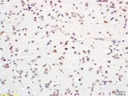 ASCL1 Rabbit anti-Human, Polyclonal, Bioss 100 &mu;L; Unconjugated:Antibodies,