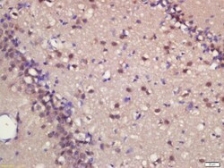 ASCL1 Rabbit anti-Human, Polyclonal, Bioss 100 &mu;L; Unconjugated:Antibodies,
