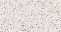 Neuro D4/DPF1 Rabbit anti-Human, Polyclonal, Bioss 100 &mu;L; Unconjugated:Antibodies,