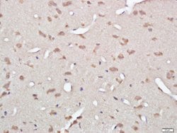 Gelsolin Rabbit anti-Human, Polyclonal, Bioss 100 &mu;L; Unconjugated:Antibodies,