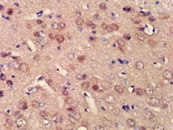 BPTF/FALZ Rabbit anti-Human, Polyclonal, Bioss 100 &mu;L | Buy Online | Bioss | Fisher Scientific