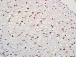 Aggrecan Rabbit anti-Human, Polyclonal, Bioss 100 &mu;L; Unconjugated:Antibodies,
