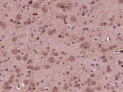 Aggrecan Rabbit anti-Human, Polyclonal, Bioss 100 &mu;L; Unconjugated:Antibodies,