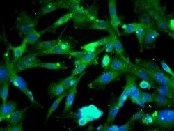 Beta catenin Rabbit anti-Human, Polyclonal, Bioss 100 &mu;L; Unconjugated:Antibodies,
