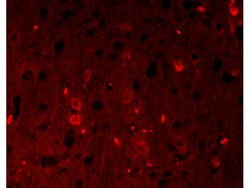 Beta catenin Rabbit anti-Human, Polyclonal, Bioss 100 &mu;L; Unconjugated:Antibodies,