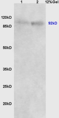 Beta catenin Rabbit anti-Human, Polyclonal, Bioss 100 &mu;L; Unconjugated:Antibodies,