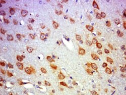 PICALM/CALM Rabbit anti-Human, Polyclonal, Bioss 100 &mu;L; Unconjugated:Antibodies,