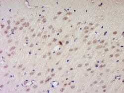 PNUTS/PPP1R10 Rabbit anti-Human, Polyclonal, Bioss 100 &mu;L; Unconjugated:Antibodies,
