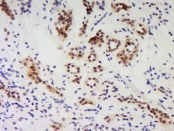 PNUTS/PPP1R10 Rabbit anti-Human, Polyclonal, Bioss 100 &mu;L; Unconjugated:Antibodies,
