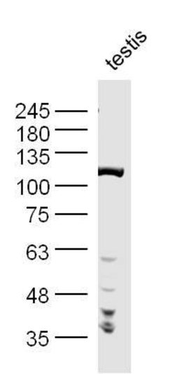PNUTS/PPP1R10 Rabbit anti-Human, Polyclonal, Bioss 100 &mu;L; Unconjugated:Antibodies,