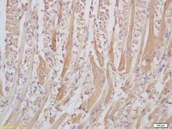 Senataxin/SETX Rabbit anti-Human, Polyclonal, Bioss 100 &mu;L; Unconjugated:Antibodies,