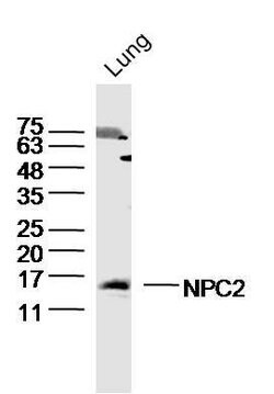 NPC2/Niemann Pick C2 Rabbit anti-Human, Polyclonal, Bioss 100 &mu;L; Unconjugated:Antibodies,
