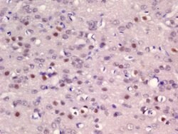 ER81 Rabbit anti-Human, Polyclonal, Bioss 100 &mu;L; Unconjugated:Antibodies,