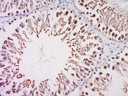 TFIID/TATA binding protein TBP Rabbit anti-Human, Polyclonal, Bioss 100