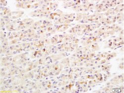 IL-17 Rabbit anti-Human, Polyclonal, Bioss 100 &mu;L; Unconjugated:Antibodies,