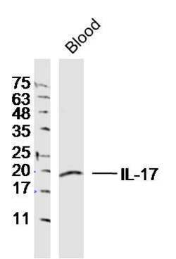 IL-17 Rabbit anti-Human, Polyclonal, Bioss 100 &mu;L; Unconjugated:Antibodies,