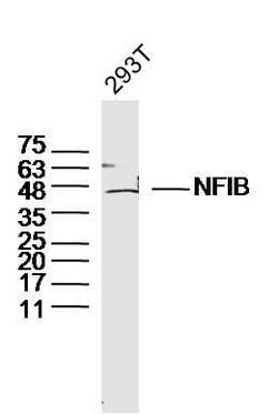 NFIB/NF1B2 Rabbit anti-Human, Polyclonal, Bioss 100 &mu;L | Buy Online | Bioss | Fisher Scientific