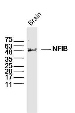 NFIB/NF1B2 Rabbit anti-Human, Polyclonal, Bioss 100 &mu;L | Buy Online | Bioss | Fisher Scientific