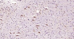 NME4/nm23-H4 Rabbit anti-Human, Polyclonal, Bioss 100 &mu;L; Unconjugated:Antibodies,
