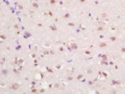 RFX4 Rabbit anti-Human, Polyclonal, Bioss 100 &mu;L; Unconjugated:Antibodies,
