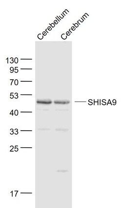 SHISA9 Rabbit anti-Human, Polyclonal, Bioss 100 &mu;L; Unconjugated:Antibodies,